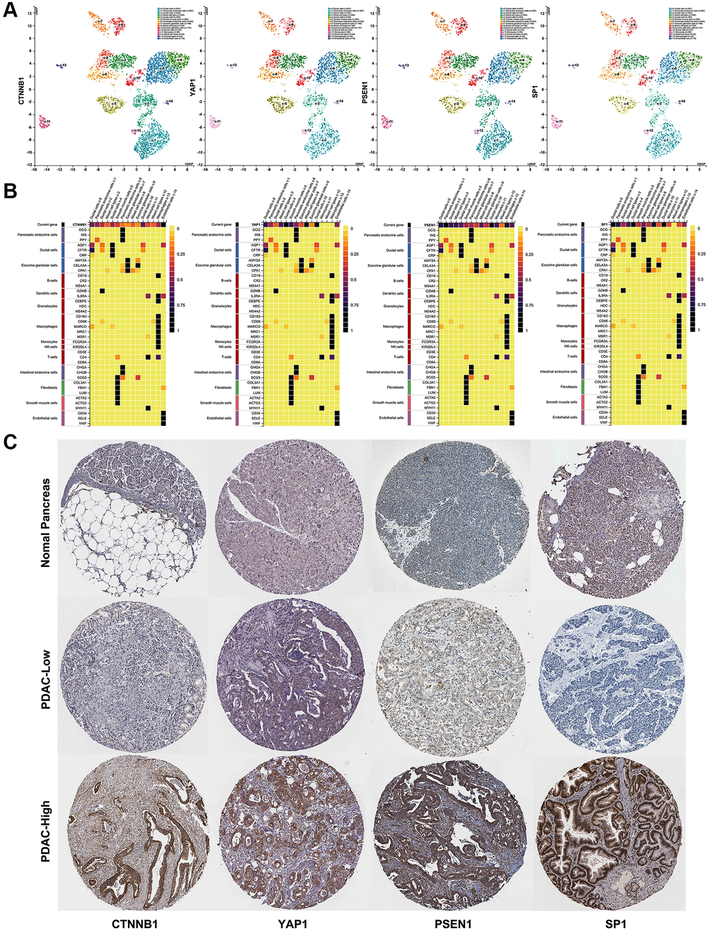 The distribution and expression of four hub genes (CTNNB1, YAP1, PSEN1, and SP1) in PDAC. (A) The distribution of four hub genes (CTNNB1, YAP1, PSEN1, and SP1) in different cell types of human pancreas was confirmed by scRNA-seq. (B) The expression level of four hub genes (CTNNB1, YAP1, PSEN1, and SP1) in different cell types of human pancreas were determined by scRNA-seq. (C) The protein levels of four hub genes (CTNNB1, YAP1, PSEN1, and SP1) expression in PDAC and normal pancreas tissues were determined by immunohistochemical staining data from HPA. scale bar, 100 mm.