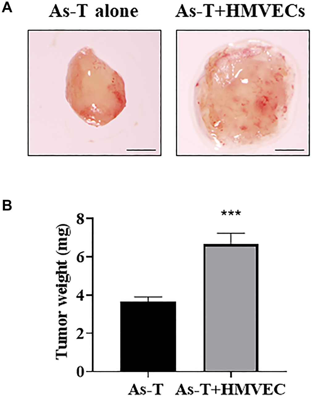 Human endothelial cells greatly promoted As-T cells to induce tumor growth. As-T cells and human dermal microvascular endothelial cells (HMVECs) were trypsinized, mixed in a 1:9 ratio with serum-free medium, and carried by the PLGA sponges for the implantation onto the CAM of 8 days old chicken embryos. As-T cells alone were used as a control. The tumors were harvested 12 days after the implantation. (A) Representative tumors. Scale, 1 mm. (B) The weight of plugs (n = 7 for each group). ***p 