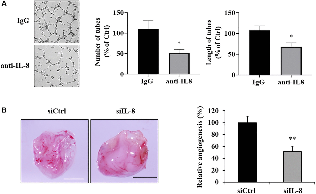 IL-8 generated by As-T cells was required for angiogenesis in vitro and in vivo. (A) IgG or anti-IL-8 neutralizing antibody was added to the CM of As-T cells and incubated for 30 min, then the CM was mixed with starved HUVECs in basic EBM2 in a 1:1 ratio to perform the tube formation assay as described above. The images of the tubular structures were captured 6–12 h later using an inverted microscope at 4× magnification. Left panel: representative images of the tubular structures. Middle panel: quantification of the number of the tubular structures. Right panel: quantification of the length of the tubular structures. *p B) IL-8 was knocked down in As-T cells by transfection of siRNA against IL-8, and angiogenesis assay was performed to evaluate the effects of IL-8 silencing on angiogenesis using CAM model. Left panel: representative plugs from siRNA scrambled control (siCtrl) and siIL-8 groups. Scale is 2 mm. Right panel: the number of blood vessel branches was counted from eight replicates and normalized to that of the control group. **p 