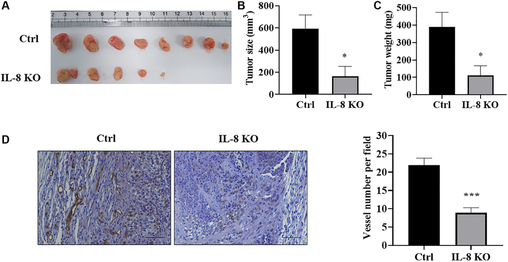 IL-8 knockout in As-T cells attenuated tumor growth and angiogenesis using HMVEC/As-T co-implantation animal model. IL-8 was knocked out in As-T cells using the CRISPR/Cas9 technique. The HMVEC cells (0.9 × 106) were mixed with wild type Ctrl or IL-8 KO As-T cells (0.1 × 106) in basic EBM2 medium and then mixed with 1:1 (v/v) growth factor-reduced Matrigel. The cell suspension was subcutaneously injected into flanks of nude mice at 6 weeks of age. The tumors were harvested 6 weeks after the implantation. (A) Representative tumors were shown. (B) The size of tumors. *p C) The weight of the tumors. *p D) IHC staining of CD31 in tumors. Left panel: representative images of IHC staining. Scale, 50 μm. Right panel: quantification of the microvessel structures in the IHC images. ***p 
