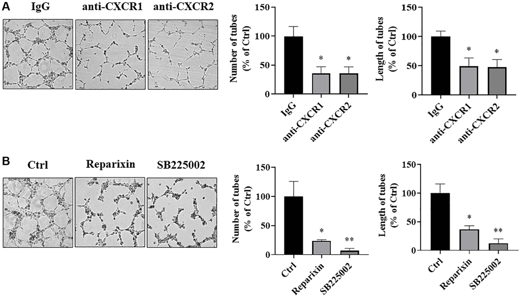 IL-8 receptors in vascular endothelial cells were required for angiogenesis. (A) HUVECs were starved overnight and resuspended in basic EBM2 medium supplemented with IgG or anti-CXCR1 or anti-CXCR2 neutralizing antibodies for 30 min. Then the cells were mixed with CM from As-T cells in a 1:1 ratio and plated in 96 well plates pre-coated with solidified growth factor-reduced Matrigel for tube formation assay. The tubular structures were imaged at 6–12 h at 4× magnification. Left panel: representative images of the tubular structure. Middle panel: the number of tubular structures was measured. Right panel: the length of the tubular structures was measured. *p B) HUVECs were starved overnight. The cells were then treated with DMSO, Reparixin (CXCR1 inhibitor), or SB225002 (CXCR2 inhibitor) for 2 h. The tube formation assay was performed as above. The tubular structures were imaged at 6–12 h using a microscope at 4× magnification. Left panel: the representative images of the tubular structure. Middle panel: quantification of the number of the tubular structures. Right panel: quantification of the length of the tubular structures. * and **p p 