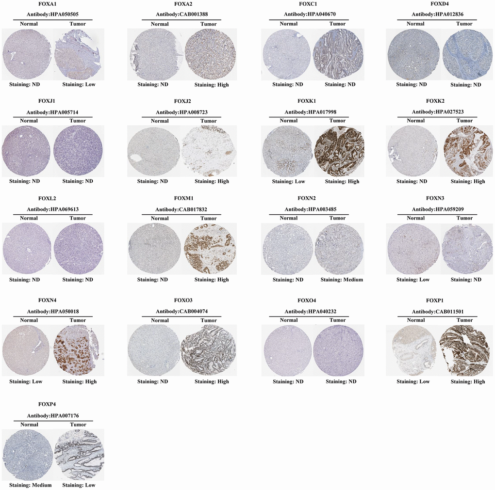 Representative immunohistochemical images of FOX proteins in HCC samples and the normal liver tissues. ND: Not detectable.