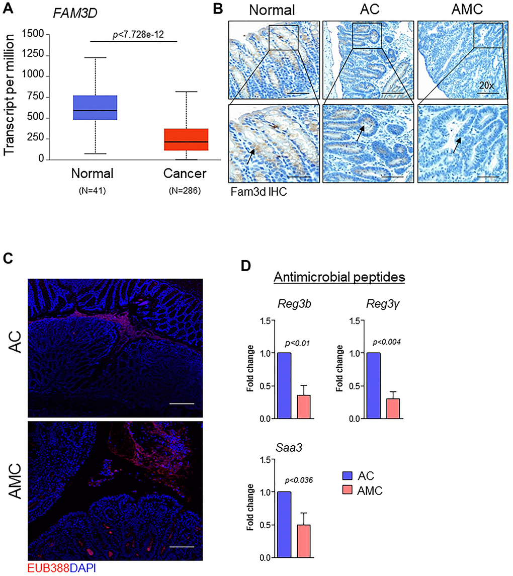 Muc4 deletion results in defective mucus barrier function and reduced intestinal homeostasis molecules. (A) TCGA-COAD dataset showed down-regulation of FAM3D in CRC patients (N = 286) compared with healthy controls (N = 41). (B) Immunohistochemistry analysis of Fam3d expression in the colon of normal, AC, and AMC mice. n = 6 (AC and AMC) and n=3 for normal group. (C) Representative images of immunofluorescent staining of bacteria (red color) done by fluorescence in-situ hybridization using EUB338-Cy3 probe. n = 3 per group. (D) mRNA expression levels of antimicrobial peptides (Reg3b, Reg3γ, and Saa3) in the colons of AC and AMC mice were measured by real-time PCR. n = 3-4 per group.