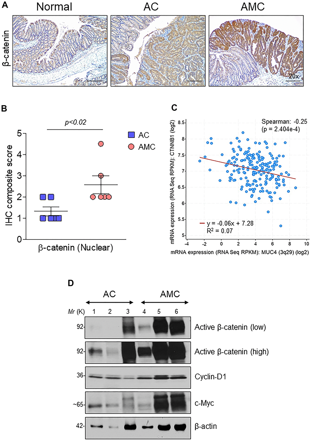 Muc4 deletion results in up-regulation of β-catenin signaling. (A) Immunohistochemical analysis of β-catenin in normal, AC and AMC animals. n = 6 (AC and AMC) and n=3 for normal group. (B) IHC composite score of nuclear β-catenin staining in AC and AMIC mice (C) MUC4 and CTNNB1 (β-catenin) correlated negatively in the TCGA-COAD dataset. (D) Immunoblot of active β-catenin and its target genes: cyclin-D1 and c-Myc expression in AC and AMC animals. n = 3 per group.