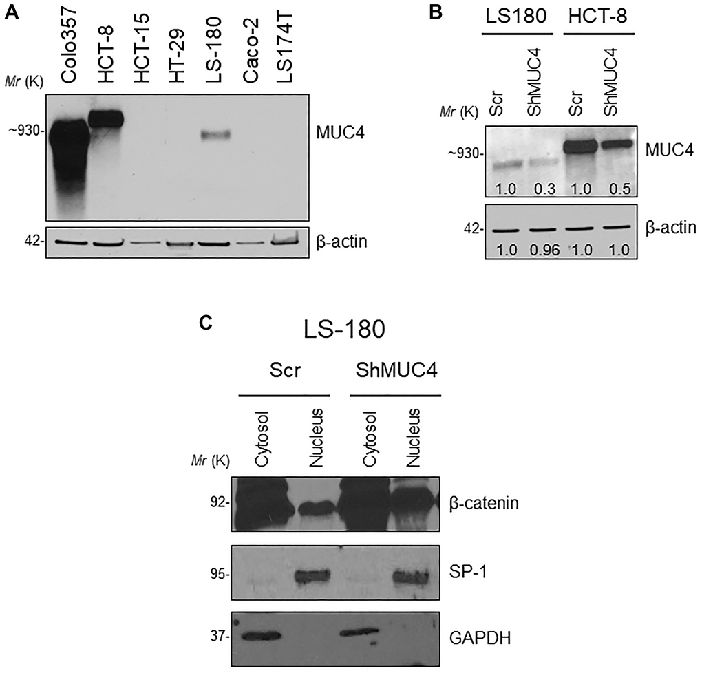 Knockdown (KD) of MUC4 in CRC cell lines mediates β-catenin signaling. (A) A panel of CRC cell lines was used and screened for MUC4 expression (Colo357 pancreatic cancer cell line used as a positive control). (B) Stable KD of MUC4 in both LS-180 and HCT-8 CRC cell lines. (C) Expression of nuclear β-catenin levels in a sub-cellular fraction of CRC cell line done by western blot.