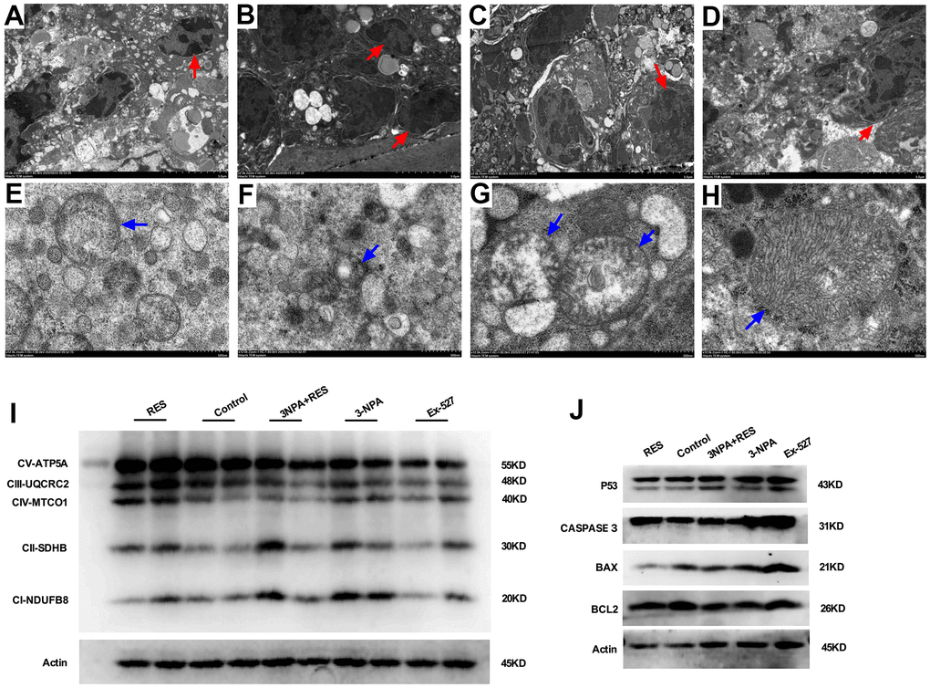 Mitochondrial oxidative phosphorylation-induced apoptosis may result in oxidative stress-induced POI. (A) Granulosa cells in ovarian tissue from the control group. (B) In the 3-NPA model group, GCs apoptosis and nuclear pyknosis were obvious, the chromatin margin was set, organelle structure was destroyed, and empty shots appeared. (C) Obvious granulocyte apoptosis was observed in ovarian tissue from mice in the Ex-527 intervention group; chromatin agglutination and vacuoles were also observed. (D) Ovarian granulocyte apoptosis was significantly lower in the resveratrol intervention group than in the model group. (E) Mitochondrial morphology in ovarian tissue from mice in the control group was largely normal, and the number of mitochondria was high. (F) In the 3-NPA group, mitochondrial morphology in ovarian tissue was destroyed, stromal edema was obvious, and the endoplasmic reticulum was dilated and damaged. (G) Ovarian mitochondria in mice from the Ex-527 intervention group were obviously swollen and cavitated. (H) Ovarian mitochondria in the resveratrol intervention group showed significantly improved morphology; the mitochondrial crest was clearly visible, and the mitochondrial matrix was uniform. (I) OXPHOS expression was down-regulated in the Ex-527 and 3-NPA groups, while it was up-regulated in the Res group. (J) P53, BAX, and CASPASE3 were up-regulated in the Ex-527 and 3-NPA groups and down-regulated in the Res group. BCL2 was down-regulated in the Ex-527 and 3-NPA groups, while it was up-regulated in the Res group. Red arrow: granular nucleus; Blue arrow: mitochondria.