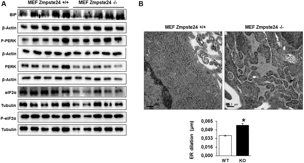 Immortalized MEF Zmpste24 KO cells present an increase in ER-stress. (A) Immunoblot analysis of BIP, P-PERK, PERK, eiF2α and P- eiF2α using both, β actin and Tubulin as loading control, in the cell extracts in basal state (n = 5). The plot indicates the quantification data of eiF2α/β-actin ratio, P-eiF2α 62/eiF2α ratio, BIP/Tubulin ratio and P-PERK/PERK ratio in the basal state. Data represent the mean ± standard error of the mean (SEM). Differences were determined by unpaired Student t-test analysis. *p **p ***p n = 5). (B) Electron microscopy of ER of MEF Zmpste24 WT and KO cells in basal state. The plot indicates the quantification data of ER dilation using image J. *p 