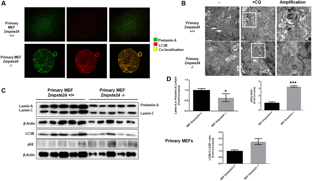 Primary cells from Zmpste24 KO cells also exhibit an increase in autophagic flux. (A) Immunofluorescence of Primary MEF Zmpste24 WT and KO cells under basal state using both an LC3B II/I antibody and a prelamin A antibody to see the co-localization signal. (B) Electron microscopy of Primary MEF Zmpste24 WT and KO cells in both basal states and treated with CQ (20 μM) during 24 hours. Enlargement of areas with accumulation of autophagosomes after treated with CQ. (C) Immunoblot analysis of Lamin A (in Primary MEF Zmpste24 WT cells), prelamin A (in Primary MEF Zmpste24 KO cells), LC3B II-I ratio and p62 using β actin as loading control, in the cell extracts in basal state (n = 5). (D) The plot indicates the quantification data of Lamin A or prelamin A/β-actin ratio, p62/β-actin ratio and LC3B II/LC3B I ratio in the basal state. Data represent the mean ± standard error of the mean (SEM). Differences were determined by unpaired Student t-test analysis. *p ***p n = 5).