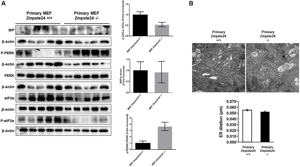 ER stress is not increased in primary Zmpste24 KO cells. (A) Immunoblot analysis of BIP, P-PERK, PERK, eiF2α and P- eiF2α using β actin as loading control, in the cell extracts in basal state (n = 5). The plot indicates the quantification data of eiF2α/β-actin ratio, P-eiF2α 62/eiF2α ratio, BIP/Tubulin ratio and P-PERK/PERK ratio in the basal state. Data represent the mean ± standard error of the mean (SEM). Differences were determined by unpaired Student t-test analysis. (B) Electron microscopy of ER of Primary MEF Zmpste24 WT and KO cells in basal state. The plot indicates the quantification data of ER dilation using Image J.