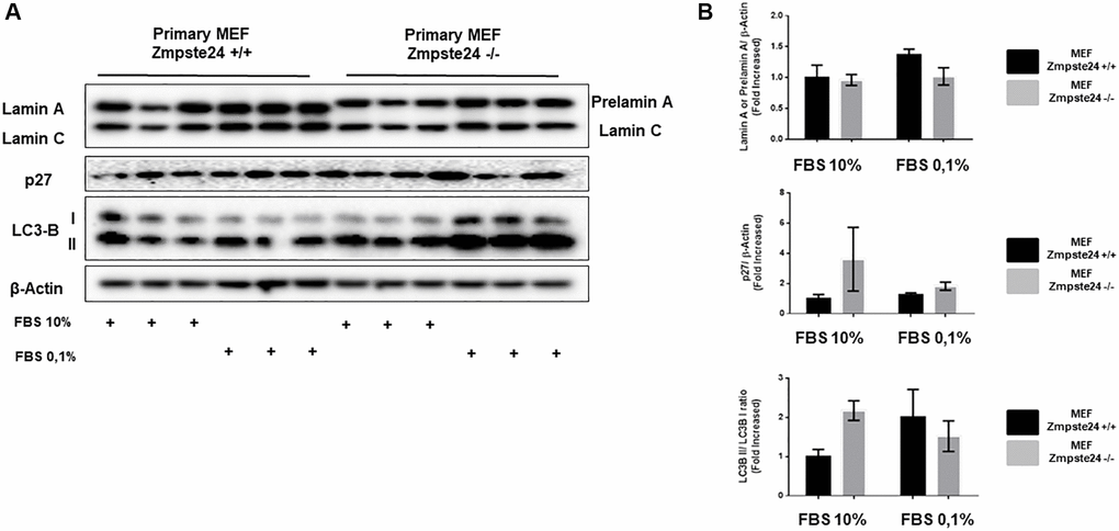 Primary MEF Zmpste24 KO cells exhibit a blockade of the cell cycle in the basal state. (A) Immunoblot analysis of Lamin A (in Primary MEF Zmpste24 WT cells), prelamin A (in Primary MEF Zmpste24 KO cells), p27 and LC3B II–I ratio using β actin as loading control, in the cell extracts with FBS reduction (n = 3). (B) The plot indicates the quantification data of Lamin A or prelamin A/β-actin ratio, p27/β-actin ratio and LC3B II/LC3B I ratio of Primary MEF Zmpste24 WT and KO in both in growth state and in nutrient deprivation. Data represent the mean ± standard error of the mean (SEM). Differences were determined by Dunnett's multiple comparisons test.