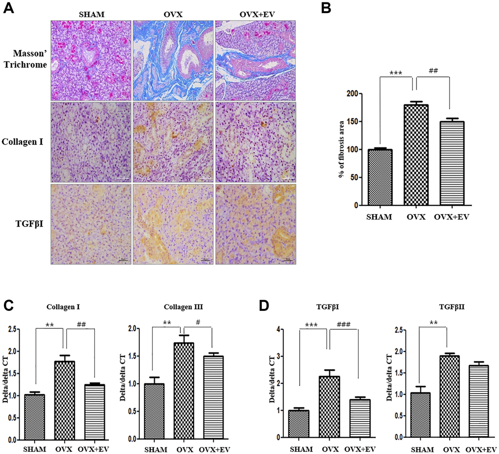 Anti-fibrotic effect of T-MSCs-derived extracellular vesicles. In the results of morphometric analysis, the fibrotic area was significantly higher in the OVX groups than in the SHAM group. The OVX+EV group showed decreased collagen type I and TGF-βI expression. Quantitative polymerase chain reaction (qPCR) analysis of collagen I and III in the submandibular gland (A and B). The mRNA expression of collagen I and III increased in the OVX group and decreased mRNA expression of collagen I and III in the OVX+EV group, compared with that in the SHAM group (C). qPCR analysis of TGF-β1 and TGF-βII in the submandibular gland. The mRNA expression of TGF-β1 and TGF-βII increased in the OVX group and decreased mRNA expression of TGF-β1 in the OVX+EV group, compared with that in the SHAM group (D). One-way ANOVA test; **p ***p ##p ###p 