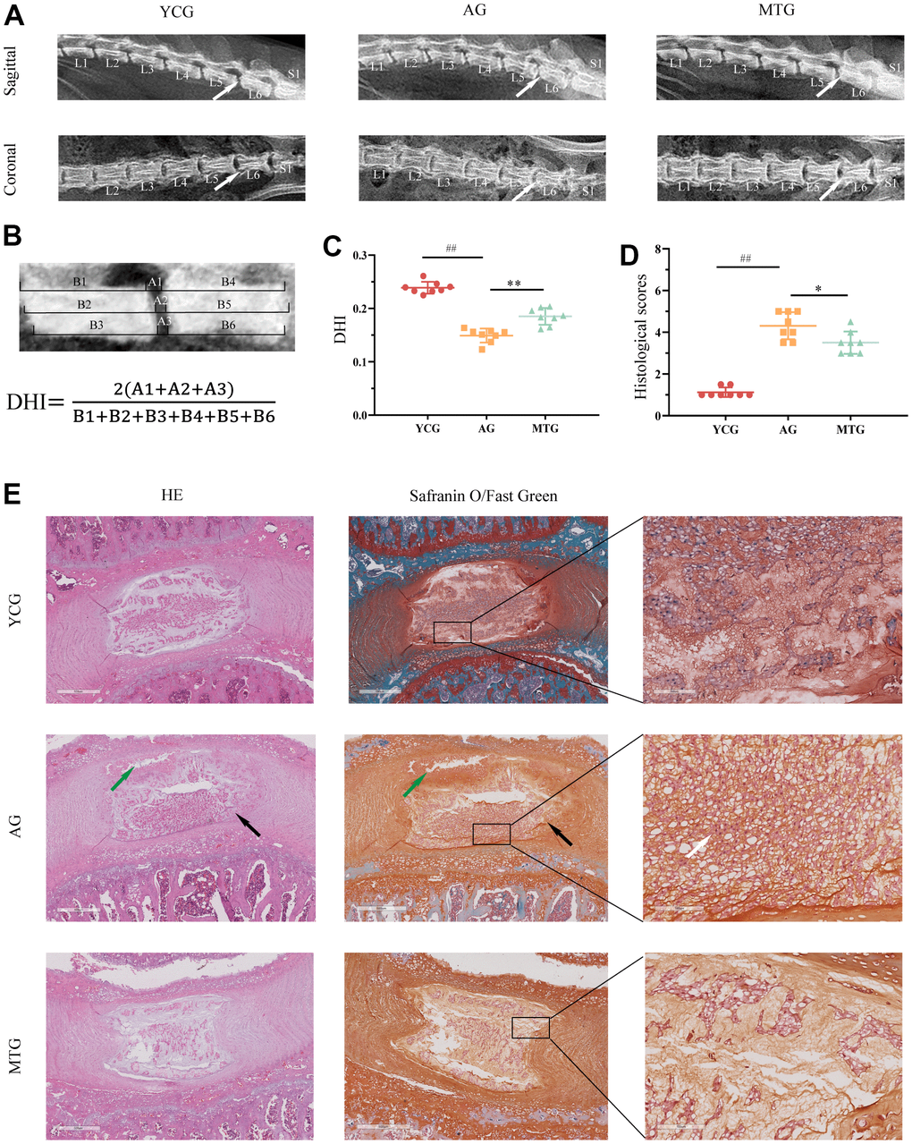MT improved degenerative changes in the lumbar IVDs with aging. (A) Radiographs showed the sagittal and coronal view of representative L5/L6 vertebrae. (B) DHI was measured on sagittal radiographs with the equation below. (C) Quantification analysis was used for DHI. (D) Histological scores of disc degeneration were analyzed. (E) The tissue sections were stained with HE and Safranin O/Fast Green (bar = 500 and 100 μm). The white arrow indicates severe degenerative phenotypes, the black arrow indicates inner layers buckling inward, and the green arrow shows partial necrosis in the disc. Values are expressed as the mean ± SD (N = 8). Compared with the YCG, ##P *P **P 