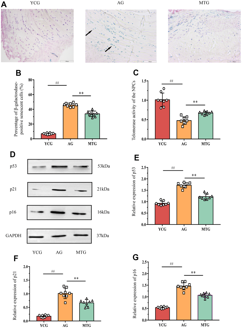 MT retarded the senescence of NPCs in lumbar IVDs. (A) SA-β-Gal staining showed the cellular senescence in discs (bar = 100μm). The blue cells indicated by the black arrow are senescence-related positive cells. (B) The percentage of SA-β-Gal positive cells was calculated. (C) Telomerase activity of the NPCs was indirectly reflected by the relative mRNA expression of telomerase reverse transcriptase detected by PCR. (D–G) Western blot analysis showed the relative expressions of senescence-related p53, p21 and p16 proteins in NPCs. Values are expressed as the mean ± SD (N = 8). Compared with the YCG, ##P **P 