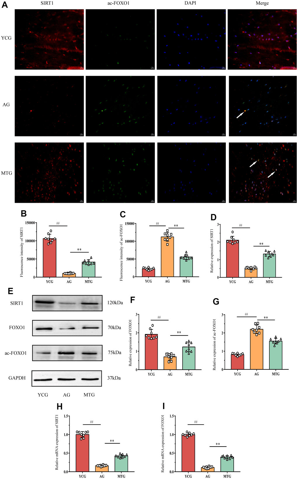 MT exerted its effects through regulating the SIRT1/FOXO1 pathway. (A) Immunofluorescence staining showed the expressions of SIRT1 (red fluorescent) and ac-FOXO1 (green fluorescent) (bar = 50 μm). The white arrow indicates that the two proteins were co-expressed in the NPCs. (B,C) The fluorescence intensity of SIRT1 and ac-FOXO1 was analyzed. (D–G) A Western blot analysis showed the relative expressions of SIRT1, FOXO1 and ac-FOXO1 proteins in NPCs. (H,I) PCR results showed the relative mRNA expressions of SIRT1 and ac-FOXO1. Values are expressed as the mean ± SD (N = 8). Compared with the YCG, ##P **P 