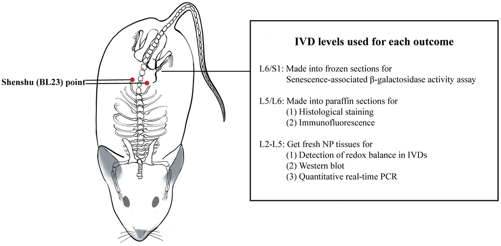 Location of Shenshu (BL23) point and IVD levels used for each outcome. IVD: intervertebral disc.