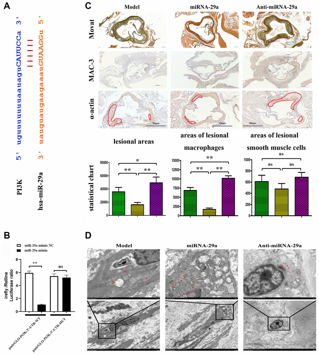 MiR-29a targets PIK3CA and inhibits atherosclerotic plaque formation in vivo. (A) MiR-29a binds to the PIK3CA gene. (B) The luciferase activity of pmirGLO reporter gene is reduced after co-transfection with pmirGLO-PI3K-3'-UTR-WT and hsa-miR-29a mimic, but it shows no statistically significant difference after co-transfection with pmirGLO-PI3K-3'-UTR-MUT and hsa-miR-29a mimic. (C) MOVAT staining and immunohistochemical staining of MAC-3 and α-SMA are performed to investigate the atherosclerotic lesion area in mice. (D) TEM is adopted to investigate the macrophage morphological changes. Data are expressed as the mean ± SD. P 