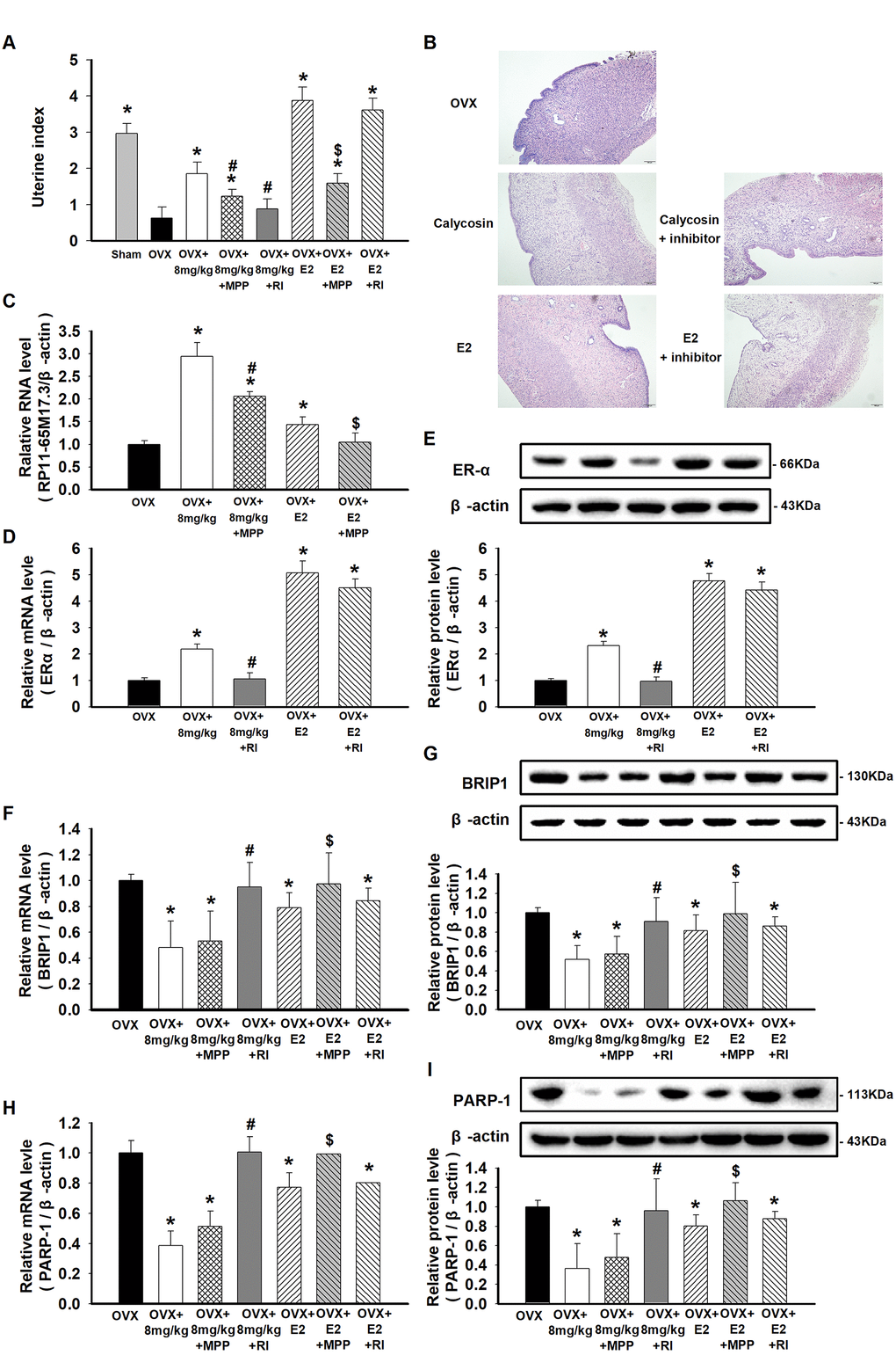 Effects of calycosin on OVX rats and the activation of the RP11-65M17.3-ERα loop in aortic ECs. (A) OVX rats were treated for 20 days with calycosin (0 or 8 mg/kg), 8 mg/kg calycosin and 5 mg/kg MPP, 8 mg/kg calycosin and RP11-65M17.3 shRNA, 20 μg/kg E2, 20 μg/kg E2 and 5 mg/kg MPP, 20 μg/kg E2 and RP11-65M17.3 shRNA. The uterine index was calculated by the percentage of the uterus weight relative to the body weight. (B) The uterine tissues were stained with HE. (C–I) The levels of RP11-65M17.3, ERα, BRIP1 and PARP-1 in aortic ECs were determined using qRT-PCR or Western blotting. Representative data from three independent experiments are shown. *p #p $p 2.