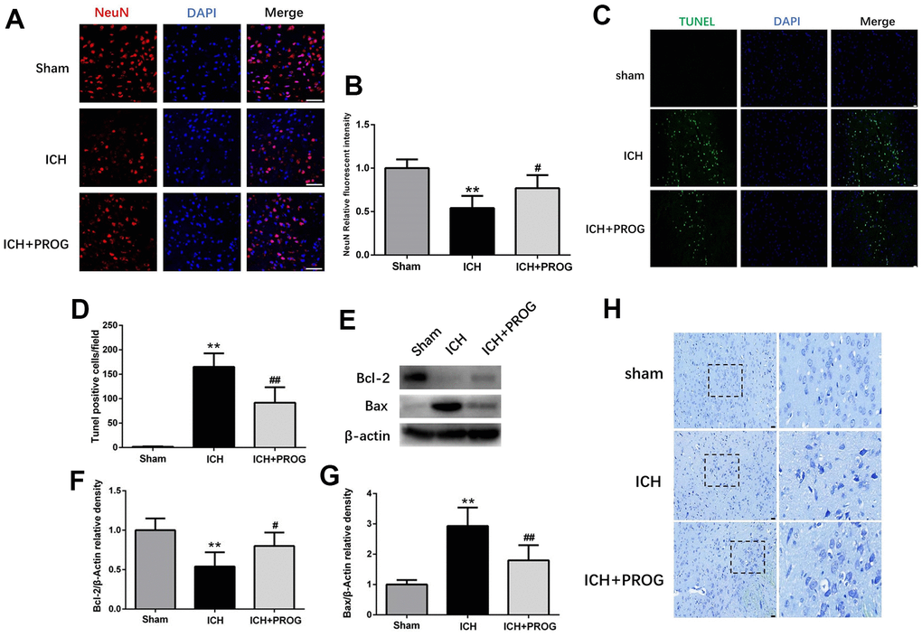 Effect of progesterone on neuron death and cell apoptosis. (A) Representative immunofluorescence staining images of NeuN (red) in perihematomal region. Nuclei were counterstained with DAPI (blue). Bar=50μm. (B) Quantitative analyses of NeuN relative fluorescent intensity in perihematomal region in each group. (C) Representative micrographs of TUNEL staining in perihematomal region in each group. Bar=50μm. (D) Quantitative analysis shows that TUNEL positive cells in perihematomal region. (E) Representative Western bands showing the protein expression of Bcl-2 and Bax in perihematomal region. (F, G) Quantitative analysis of Western blots shows that the expression of Bcl-2 and Bax changes in each group. (H) Representative Nissl-stained images in perihematomal region in each group. Bar=50μm. n = 6 animals per group. Data are expressed as the mean ± SEM; **P #P ##P 