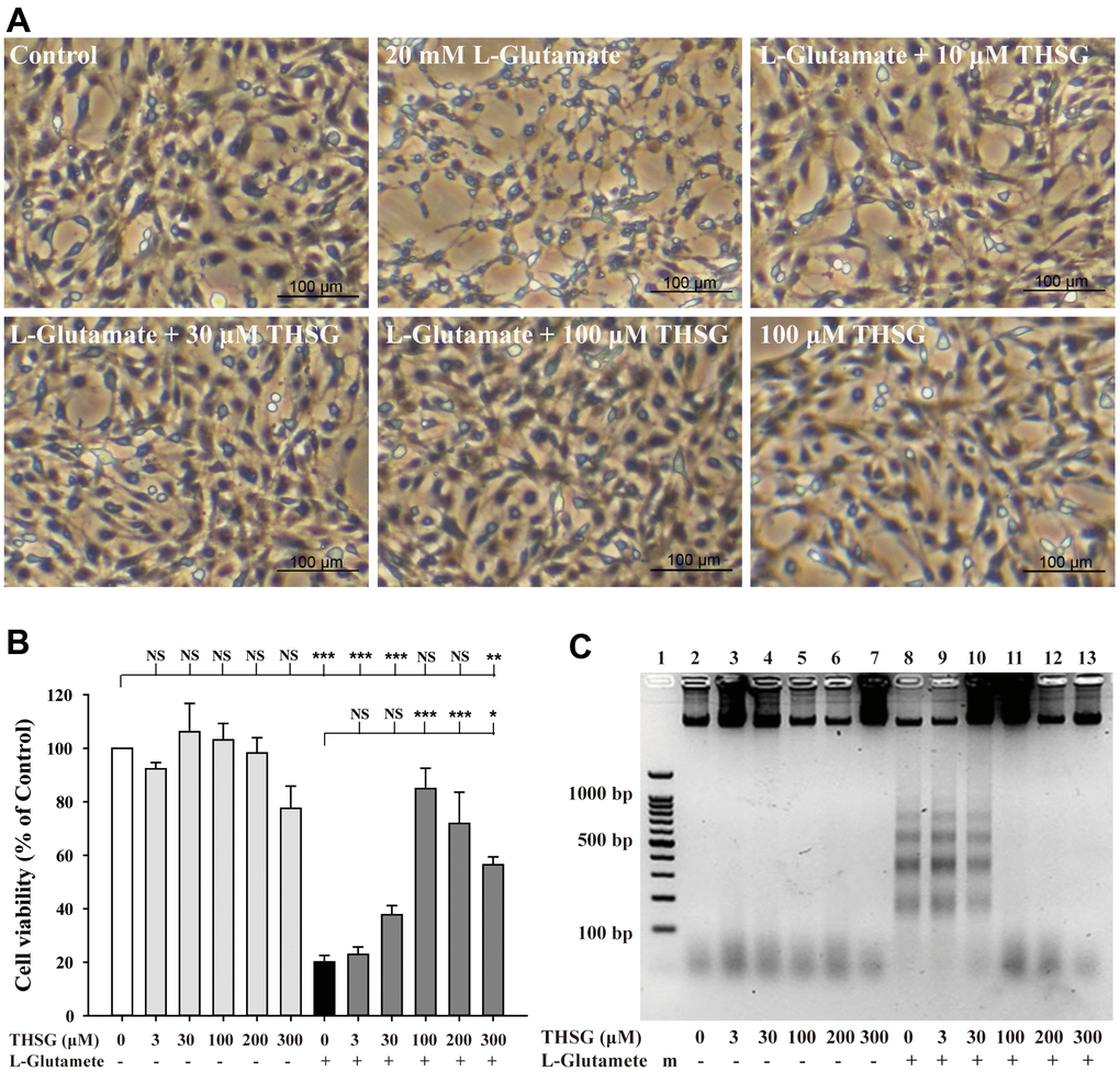 Effects of THSG on glutamate-induced DNA fragmentation and excitotoxicity. C6 neural glioma cells were treated with various concentrations of THSG (10, 30, or 100 μM) for 2 h and then treated with L-glutamate (20 mM) for 24 h. C6 glioma cell morphology images are shown in (A). Cells treated with 20 mM L-glutamate for 24 h caused drastic cell death, as demonstrated by the poor and shrunken cell morphology. Scale bar = 100 μm. Cell viability measured by the MTT assay is shown in (B) (n = 4). Note: THSG significantly rescued glioma neural cells from glutamate neurotoxicity, and the best effective dose of THSG was 100 μM, which completely prevented glutamate-induced cell death. NS = no significant difference; ** P > 0.01; *** P  0.05; **, P C) Gel electrophoresis showing the effects of THSG at a range of concentrations (3-300 μM) on L-glutamate-induced DNA fragmentation in glioma neural cells.