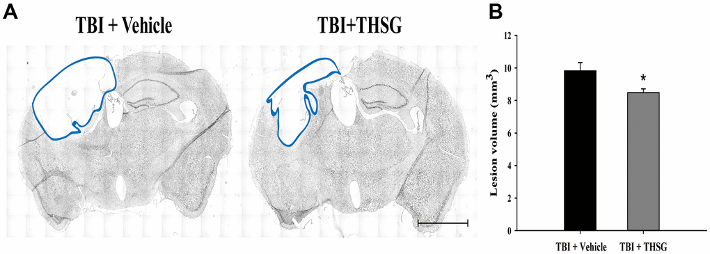 THSG treatment reduces cortical lesion volume post TBI. (A) Microphotograph representing the brain section of TBI and TBI with THSG treatment at 21 days post TBI. Lines indicate the areas of the lesion was measured (blue). Scale bar = 2 mm. (B) Quantification of the lesion size from sections. Data represent the mean ± SEM. *, P 