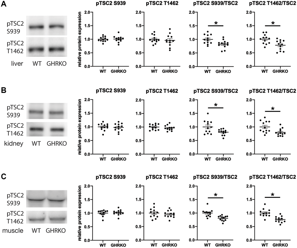 Relative phosphorylation of TSC2 is decreased in GHRKO tissues. The relative TSC2 phosphorylation at two sites S939 and T1462 was decreased in GHRKO liver (A), kidney (B), and muscle (C). N = 6 male and N = 6 female mice. *t-test p 
