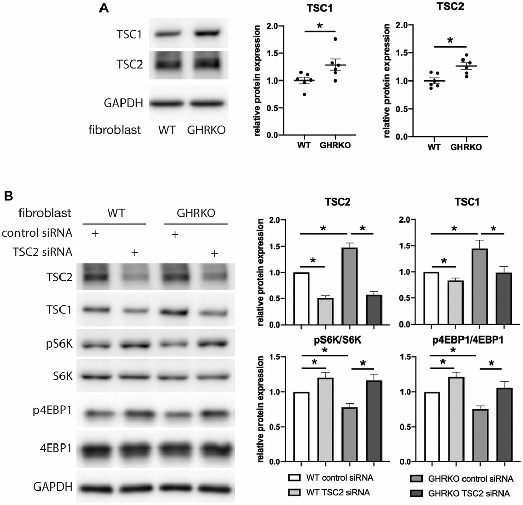 Upregulation of mTORC1 substrates by TSC2 knockdown in GHRKO cells. (A) TSC1 and TSC2 protein expression in GHRKO cells. (B) Protein expression of mTORC1 substrates in TSC2 knockdown cells. N = 6. *t-test p 