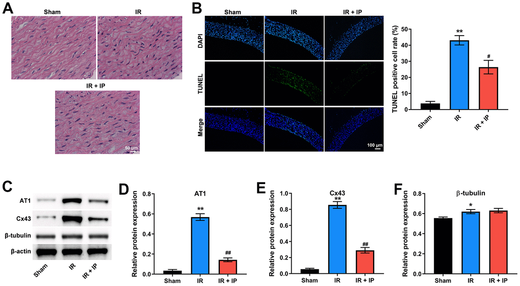 IP protected nonculprit coronary arteries against IR injury. (A) H&E staining assay was conducted to observe the morphology of nonculprit coronary arterial tissues. (B) TUNEL and DAPI staining assay was performed to detect the apoptosis of nonculprit coronary arterial tissues. (C–F) Western blot assay was used to detect the expressions of AT1, Cx43 and β-tubulin. *P#P##P