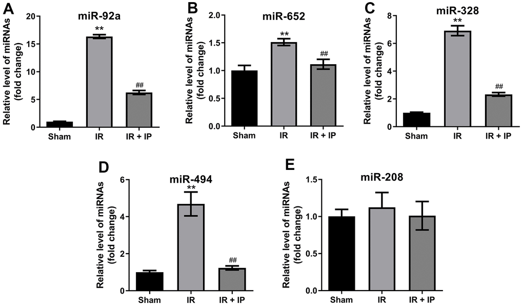 Effect of IP on miRNAs expression in nonculprit coronary arterial tissues. (A–E) RT-qPCR was performed to detect the expression of miR-92a, miR-652, miR-328, miR-494 and miR-208 in nonculprit coronary arterial tissues. **P##P