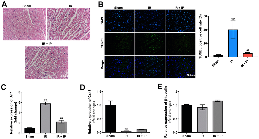 IP protected myocardial tissues against IR injury. (A) H&E staining assay was conducted to observe the morphology of nonculprit myocardial tissues. (B) TUNEL and DAPI staining assay was performed to detect the apoptosis of nonculprit myocardial tissues. (C–E) RT-qPCR assay was used to detect the expression of AT1, Cx43 and β-tubulin. **P##P
