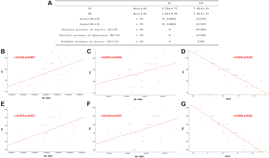 Correlations between the DTI values, NODDI values and AS, DS. (A) The value of AS and DS in two groups. (B–G) In There was a positive correlation with the values of MD and DS, AS. And the mean value of FICVF was negatively correlated with DS and AS. Abbreviations: DS: depression score; AS: anxiety score; MD: mean diffusivity; FICVF: intra-cellular volume fraction; HC: Healthy controls; PAT: patient.