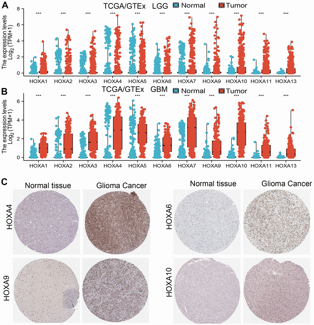 HOXAs is highly expressed in LGG. (A, B) The expression of HOXAs in LGG and GBM examine by TCGA/GTEx databases. (C) The expression of HOXAs in LGG tissue examine by HPA database.