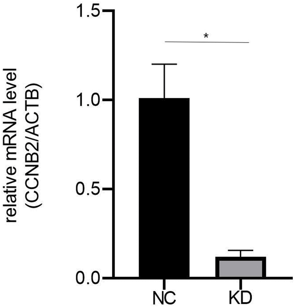 The qRT-PCR results showed that the expression level of CCNB2 in Huh-7 cell line of CCNB2-RNAi group was significantly inhibited. **p 