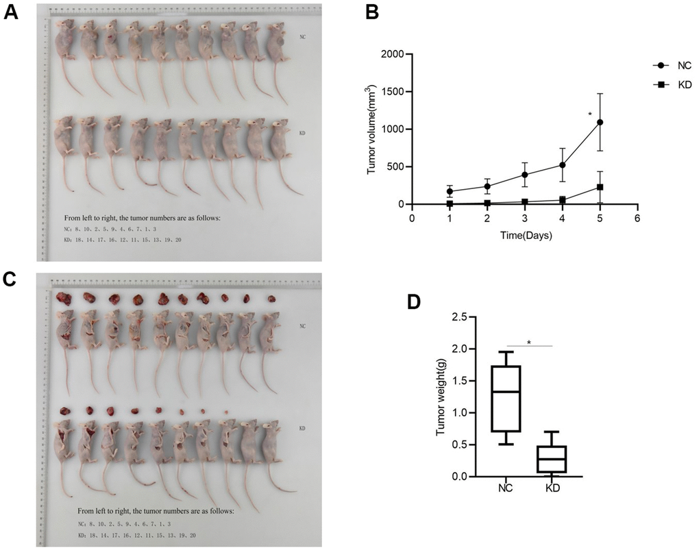 CCNB2 enhances tumour growth in nude mice. (A) Tumour formation in nude mice, the top row is NC group, the bottom row is KD group. (B) Changes of tumour volume in nude mice at five different time points. (C) Tumour of NC group and KD group at the 26th day. (D) Tumour weight in nude mice. *p 