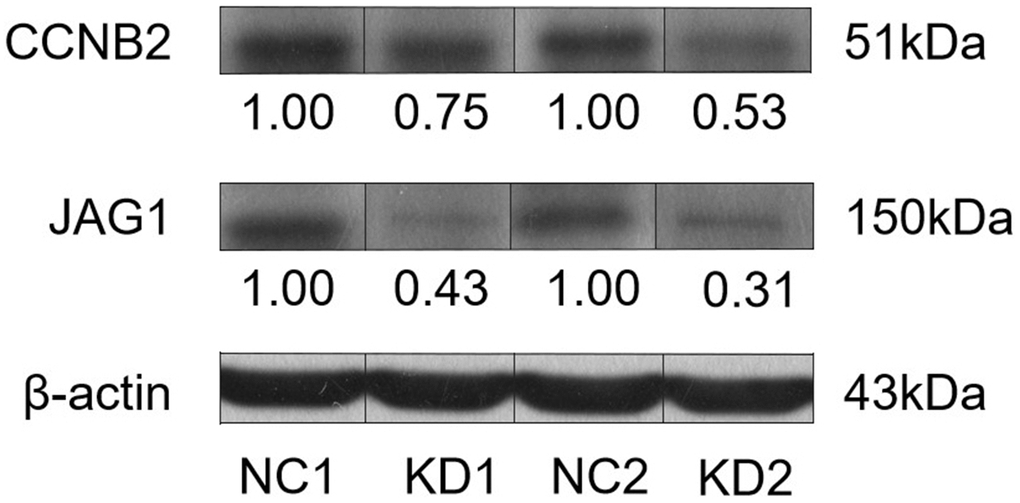 Western blot was used to detect the interaction between CCNB2 protein and JAG1 protein in the tumor tissues of nude mice.