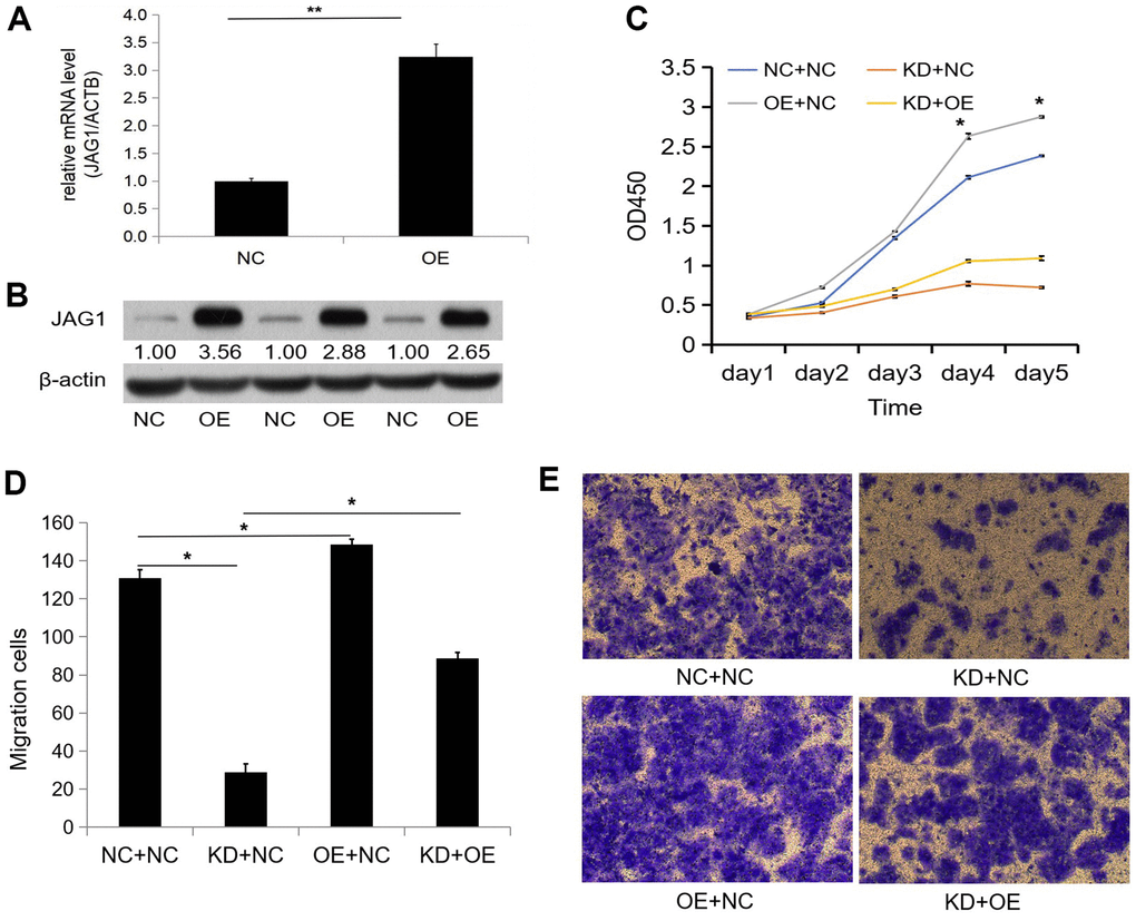 Overexpression of JAG1 restores the inhibition of proliferation and migration caused by knockdown of CCNB2. (A) The over-expression efficiency of JAG1 was detected by qPCR. (B) Western blot was used to observe the over-expression efficiency of JAG1 protein. (C) CCK-8 assays were performed after cell infection in Huh-7 cells. (D) Transwell assay observed the number of migratory cells in each group after Huh-7 cell infection. (E) Huh-7 migratory cells were detected by transwell assay. *p 