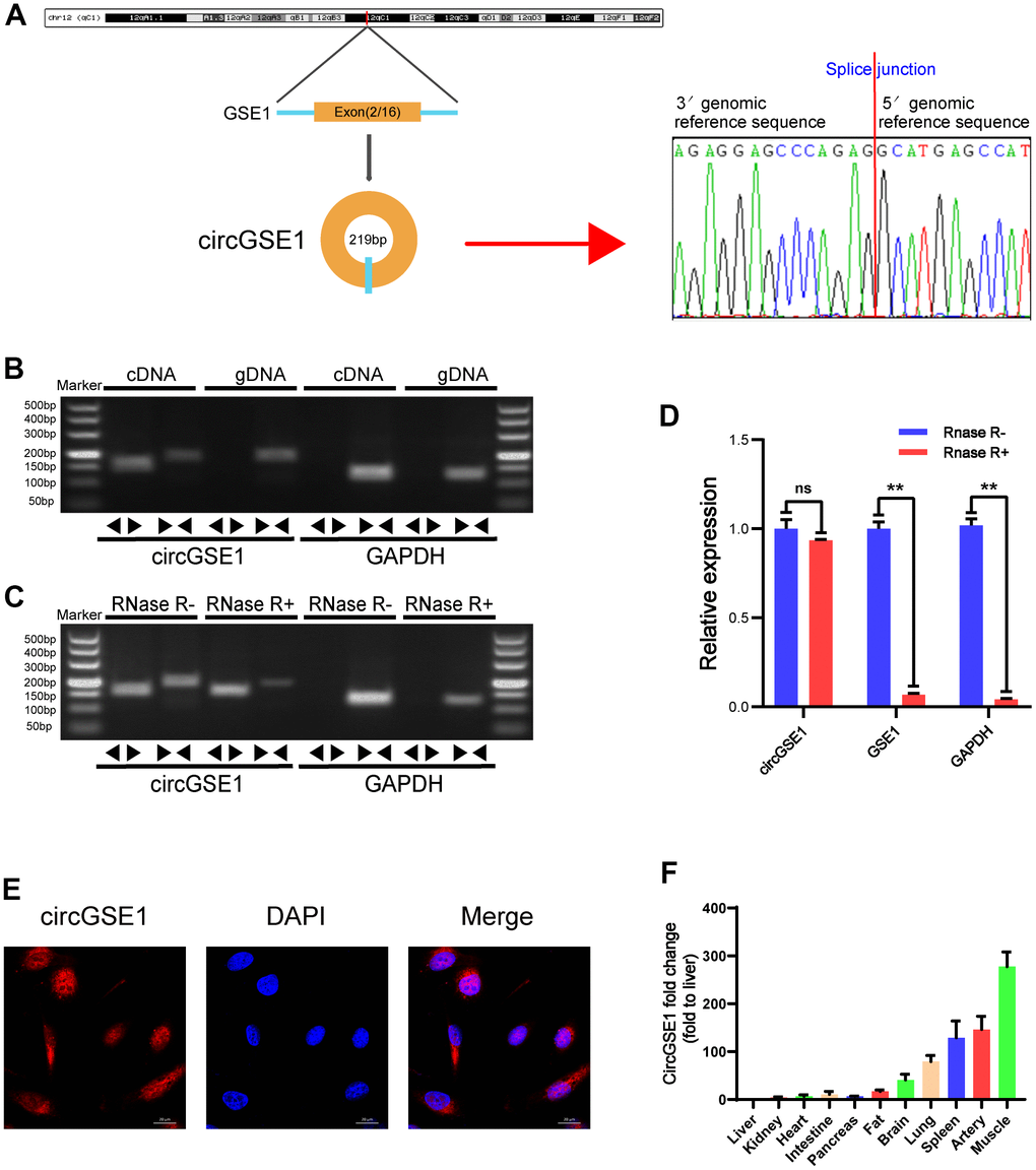 Validation of circGSE1 and differences in organization. (A) Sanger sequencing of the band amplified with divergent primers confirms head-to-tail splicing of circGSE1. (B) Agarose gel electrophoresis validated the expression of circGSE1 in MAECs. CircGSE1 was amplified by divergent primers in cDNA but not gDNA, and GAPDH was used as a negative control. (C, D) In the presence or absence of RNase R, the expression of circGSE1 and linear GSE1 RNA in MAECs was detected by qRT-PCR, and nucleic acid electrophoresis or qRT-PCR was then performed. (E) FISH experiments proved that most circGSE1 is localized in the cytoplasm. Nuclei were stained blue, and cytoplasmic circGSE1 was stained red. (magnification, 400×, scale bar, 20 μm). (F) The circGSE1 expression levels in different mouse organs were analysed by qRT-PCR, revealing higher expression in muscle, artery and splenic organs. (The data are expressed as the mean ± SD, *P 