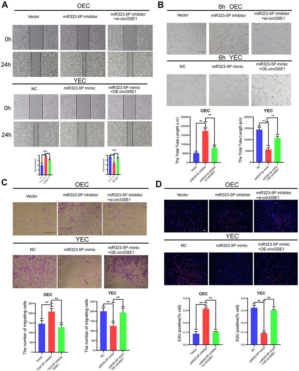 CircGSE1 regulates the angiogenic ability of MAECs via the miR-323-5p. (A) Wound healing assay of OECs treated with vector, the miR-323-5p inhibitor or the miR-323-5p inhibitor + circGSE1 siRNA and YECs treated with the NC, miR-323-5p mimic or miR-323-5p mimic+OE-circGSE1. The graph indicates the quantification of the wounded area 24 hours after scratching (n=3, scale bar: 200 μm). (B) Tube formation assay of OECs treated with the vector, miR-323-5p inhibitor or miR-323-5p inhibitor+circGSE1 siRNA and YECs treated with the NC, miR-323-5p mimic or miR-323-5p mimic+OE-circGSE1 (n=3, scale bar, 200 μm). (C) Migration assay of OECs treated with the vector, miR-323-5p inhibitor or miR-323-5p inhibitor + circGSE1 siRNA and YECs treated with the NC, miR-323-5p mimic or miR-323-5p mimic+OE-circGSE1 (n=5, scale bar, 200 μm). (D) EdU assay of OECs treated with the vector, miR-323-5p inhibitor or miR-323-5p inhibitor + circGSE1 siRNA and YECs treated with the NC, miR-323-5p mimic or miR-323-5p mimic+OE-circGSE1 (n=5, scale bar, 200 μm). (The data are expressed as the mean ± SD, *P 