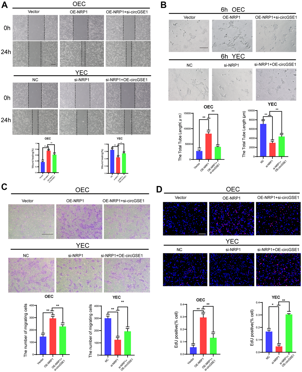 CircGSE1 regulates the angiogenic ability of MAECs via the NRP1. (A) Wound healing assay of OECs treated with vector, the OE-NRP1 or the OE-NRP1 + circGSE1 siRNA and YECs treated with the NC, NRP1-siRNA or NRP1-siRNA +OE-circGSE1. The graph indicates the quantification of the wounded area 24 hours after scratching (n=3, scale bar: 200 μm). (B) Tube formation assay of OECs treated with the vector, the OE-NRP1 or the OE-NRP1 + circGSE1 siRNA and YECs treated with the NC, NRP1-siRNA or NRP1-siRNA +OE-circGSE1 (n=3, scale bar, 200 μm). (C) Migration assay of OECs treated with the vector, the OE-NRP1 or the OE-NRP1 + circGSE1 siRNA and YECs treated with the NC, NRP1-siRNA or NRP1-siRNA +OE-circGSE1 (n=5, scale bar, 200 μm). (D) EdU assay of OECs treated with the vector, the OE-NRP1 or the OE-NRP1 + circGSE1 siRNA and YECs treated with the NC, NRP1-siRNA or NRP1-siRNA +OE-circGSE1 (n=5, scale bar, 200 μm). (The data are expressed as the mean ± SD, *P 
