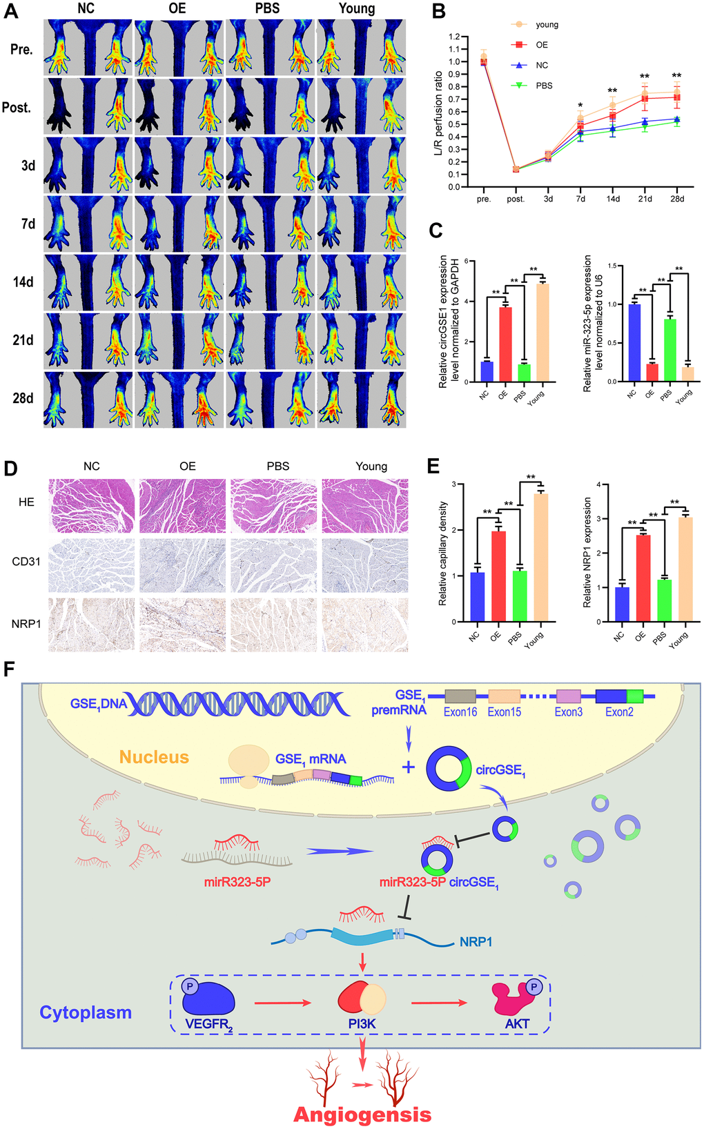 Overexpression of circGSE1 can promote blood flow recovery and angiogenesis in ageing mice. (A) Imaging of blood flow through the mouse femoral artery 3, 7, 14, 21, and 28 days after surgery (n=5). (B) The blood flow through the mouse ischaemic limbs was detected, and the results are expressed as the ratio of the perfusion of the left limb (ischaemic) to that of the right limb (control, nonischaemic) on the 7th, 14th, and 21st days after the surgery (n=5). (C) qRT-PCR analysis of circGSE1 and mi323-5p expression in the ischaemic left lower limb gastrocnemius muscles in the young mouse group, old mouse circGSE1 overexpression group and old mouse PBS group compared to the old mouse NC group; expression levels were normalized to that of GAPDH. (D, E) Representative images of HE, anti-CD31 and anti-NRP1 immunohistochemical staining of mouse left lower limb gastrocnemius muscles. The CD31 and NRP1 expression levels in the young mouse group, old mouse circGSE1 overexpression group and old mouse PBS group were compared to those in the old mouse NC group (n=5, scale bar, 100 μm) (The data are expressed as the mean ± SD, *P F) Schematic diagram of the mechanism by which circGSE1 promotes angiogenesis in ageing mice.