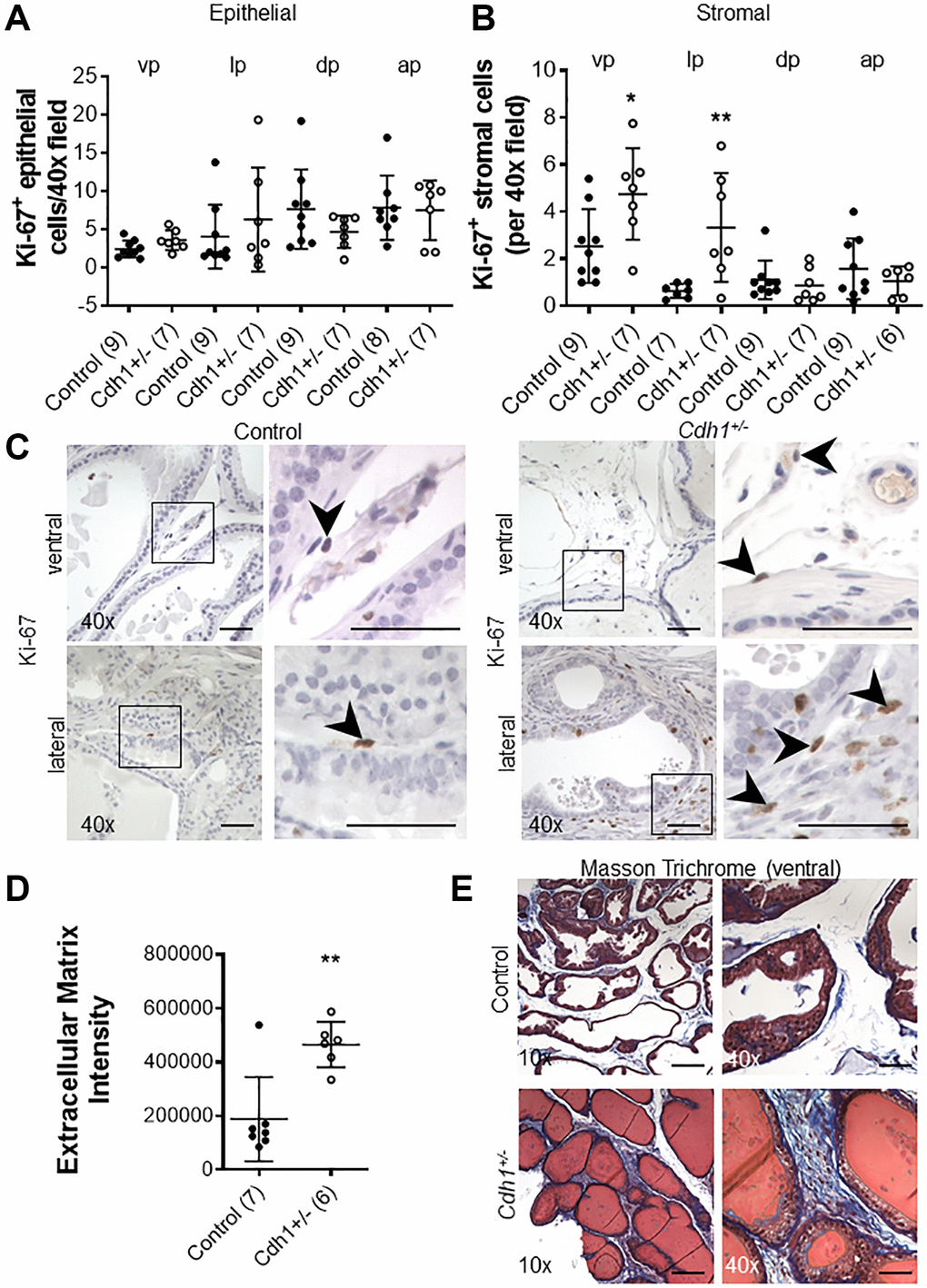 Impact of prostate epithelial specific heterozygous E-cadherin loss on proliferation and extracellular matrix deposition in the murine prostate at 24 months of age. (A) Quantification of Ki-67+ epithelial, and (B) stromal cells in the lobes of the prostate from Control and Cdh1+/- mice at 24 months of age. Abbreviations: vp: ventral prostate; lp: lateral prostate; dp: dorsal prostate; ap: anterior prostate. (C) Ki-67 immunostaining (brown) in the stromal compartments of prostate ventral and lateral lobes. Black arrows indicate Ki-67+ cells in the stromal compartment. Original magnification, 40×, inset 40×. (D) Quantification of Masson’s trichrome staining of extracellular matrix (blue) in the stroma surrounding prostate glands from ventral prostate of Control and Cdh1+/- mice at 24 months of age. Seven fields from each section were analyzed and an average score was determined for each mouse. (E) Masson’s trichrome staining in transverse sections of prostate ventral lobes in Control (top panels) and Cdh1+/- mice (bottom panels). Original magnification, 10×, inset 40×. Data represent mean ± S.D, number of mice in each group in parentheses. Lobes which had been washed away during staining process were not quantified. *p **p D) Scale bars indicate 200 μm in 10×, 50 μm 40×.