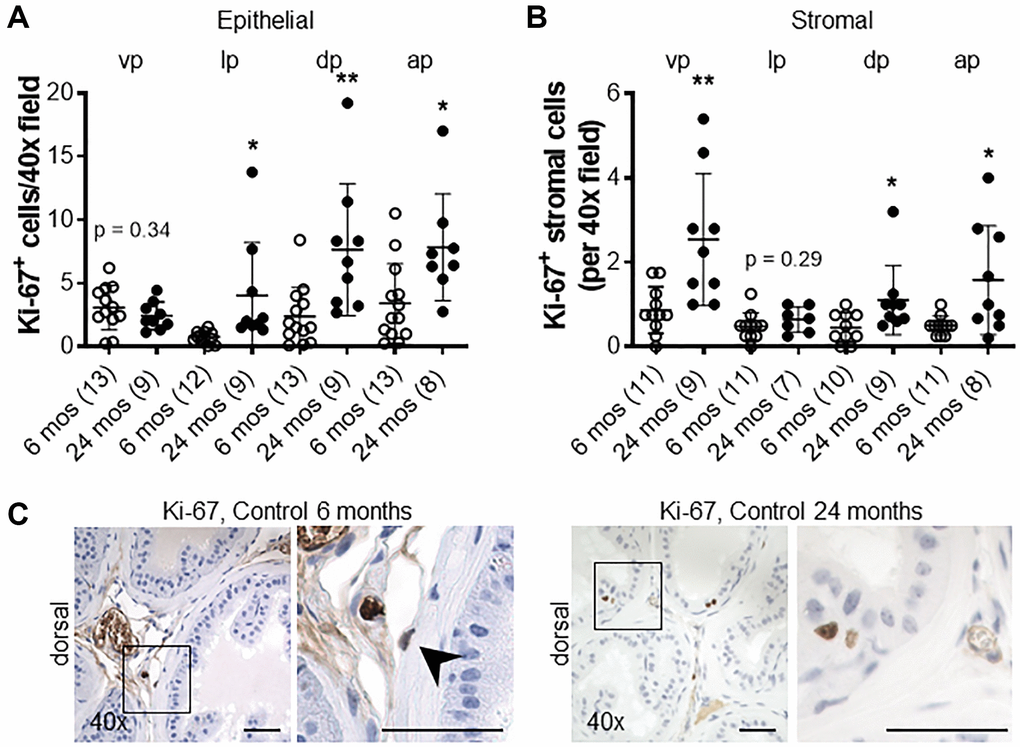 Impact of aging on proliferation in the murine prostate. (A) Quantification of Ki-67+ epithelial, and (B) stromal cells in the lobes of the prostate from control mice at 6 and 24 months of age. Abbreviations: vp: ventral prostate; lp: lateral prostate; dp: dorsal prostate; ap: anterior prostate. (C) Ki-67 immunostaining (brown) in dorsal lobes from control mice at 6 and 24 months of age. Black arrow indicates Ki-67+ stromal cell in control mice at 6 months of age. Original magnification, 40×, inset 40×. Data represent mean ± S.D, number of mice in each group in parentheses. Lobes which had been washed away during staining process were not quantified. *p **p 