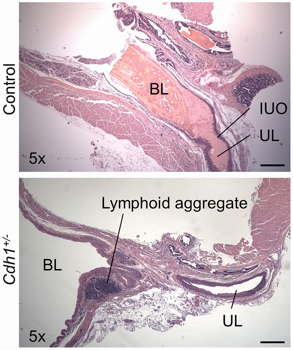 Impact of prostate-specific E-cadherin deficiency on bladder histology in mice analyzed at 24 months of age. H&E staining of transverse sections of bladder and bladder neck from Control and Cdh1+/- mice at 24 months of age. Abbreviations: BL: bladder lumen; UL: urethra lumen; IUO: Internal urethral orifice. Lymphoid aggregates (shown in Cdh1+/- image) were observed in both control and Cdh1+/- mice. Original magnification, 5×, scale bars indicate 400 μm in 5×.