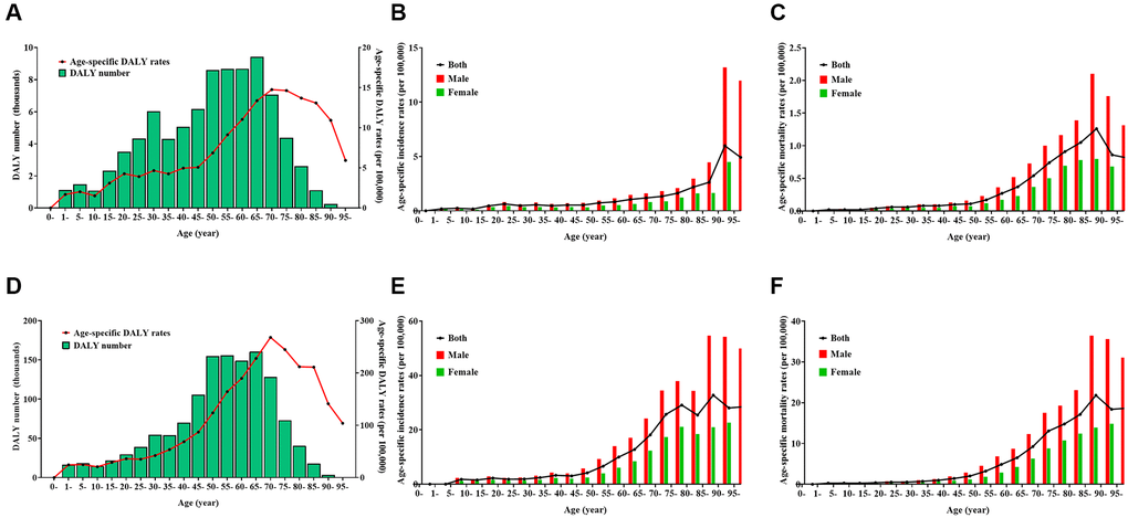 Burden of Hodgkin lymphoma (HL) and non-Hodgkin lymphoma (NHL) by age and sex in 2019. (A) number and age-standardized rates of disability-adjusted life years for HL, (B) age-standardized incidence rates for HL, (C) age-standardized mortality rates for HL, (D) number and age-standardized rates of disability-adjusted life years for NHL, (E) age-standardized incidence rates for NHL, (F) age-standardized mortality rates for NHL.