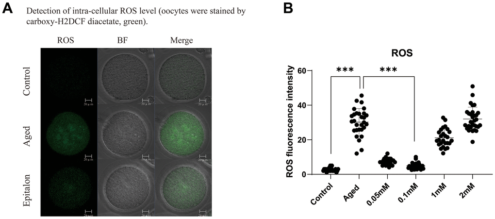 Epitalon decreased the intracellular ROS level. (A) Representative images of ROS fluorescence of in the Control, Aged, and 0.1mM Epitalon-treated aging oocytes. Images were analyzed by Confocal microscopy with identical fluorescence parameters. (B) Quantitative analysis of ROS fluorescence intensity in Control, Aged, 0.05mM, 0.1mM, 1mM, 2mM Epitalon groups. The fluorescence intensity analysis for each oocyte was conducted using Image J software. Data from more than 30 oocytes were analyzed for each group. Significant difference between the Aged and 0.1mM Epitalon-treatment groups was observed (p 