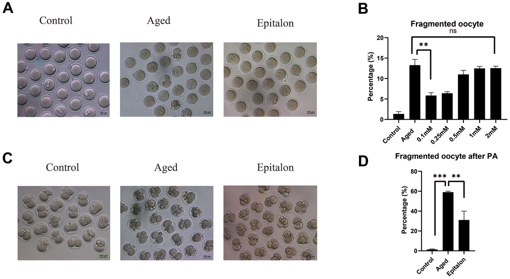 Effects of Epitalon on the integrity of postovulatory aged oocytes and after parthenogenetic activation. (A) Representative images of fragmented oocytes in the Control, Aged and 0.1mM Epitalon-treated groups. (B) The rates of oocyte fragmentation were recorded in the Control, Aged and Epitalon-treated oocytes. Epitalon was supplemented to the culture medium with a concentration of 0.1mM, 0.25mM, 0.5mM, 1mM, or 2mM. (C) Representative images of 2-cell embryos from the Control, Aged and 0.1mM Epitalon-treated groups. (D) The rates of fragmentation after parthenogenetic activation were recorded in the Control, Aged, and 0.1mM Epitalon-treated oocytes. Data from more than 30 oocytes were analyzed for each group. Significant difference between the Aged and 0.1mM Epitalon groups was observed (p 