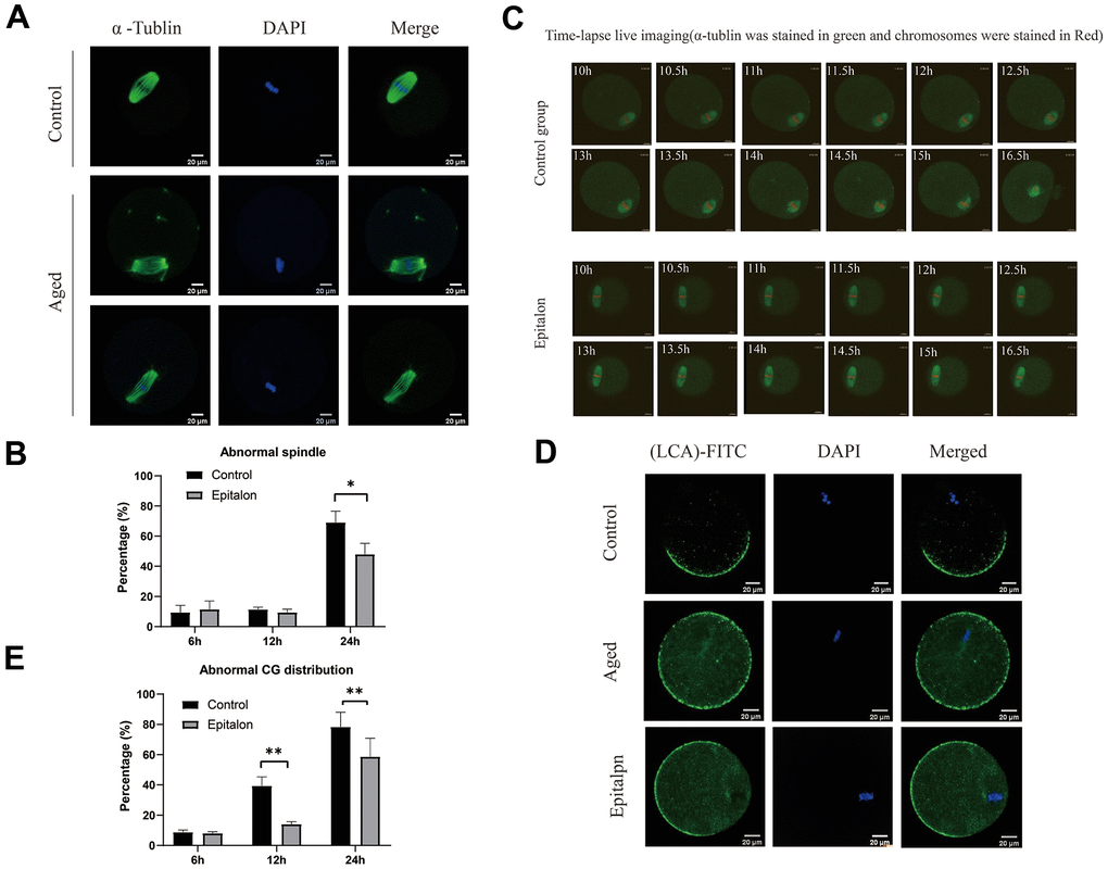 Epitalon maintained normal spindle integrity and CGs distribution. (A) Different morphological structures of spindles appeared in the Control and aged oocytes. Meiotic spindles in oocytes were stained with α-tubulin (green) and chromosomes were stained with Hoechst 33342 (blue). (B) Percentages of abnormal spindles in oocytes. Oocytes containing normal spindles and those with abnormal spindles were counted to calculate the percentage of abnormal spindles. (C) Dynamic spindle and chromosome changes in the Control and Epitalon treated oocytes, which were microinjected with MAP4-eGFP mRNA and H2B-mCherry mRNA, and visualized by time-lapse live-cell imaging. The spindles were marked in green, and chromosomes were marked in red. Independent replicates were conducted with a minimum of 20 oocytes. (D) Confocal laser scanning microscopy for the distributions of cortical granules (CGs) of oocytes. Metaphase II oocytes were immunolabeled for CGs with lens culinaris (LCA)-FITC (fluorescein isothiocyanate: green), and chromosomes were counterstained with DAPI (blue). (E) Percentages of abnormal distribution of CGs in oocytes. Significant difference between the Aged and 0.1mM Epitalon-treated groups was observed (p 