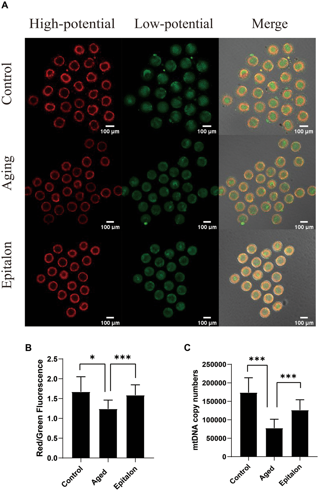 Epitalon protected the function of mitochondria during post-ovulatory oocyte aging in vitro. (A) Distribution of mitochondria with high membrane potential (red) and low membrane potential (green) in three groups of oocytes. (B) The fluorescence intensity of ratio of red/green fluorescence analysis for each oocyte was conducted using Image J software. Significant difference between the Aged and 0.1mM Epitalon-treated groups was observed (p C) mtDNA copy numbers of MII oocytes in all three groups were revealed by real-time polymerase chain reaction analysis. Data from more than 30 oocytes were analyzed for each group. Significant difference between the Aged and 0.1mM Epitalon-treated groups was observed (p 