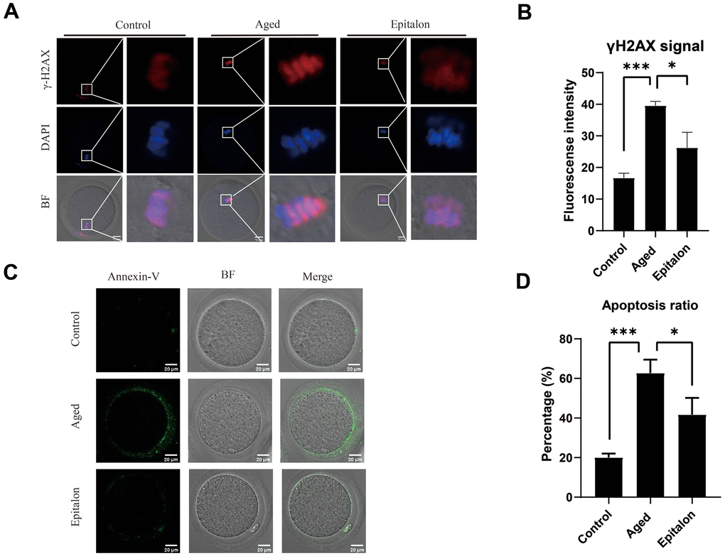 Effect of Epitalon on early apoptosis in post-ovulatory aging oocytes. (A) Representative images of DNA damage in the Control, Aged, and Epitalon-treated oocytes. Scale bar: 10 μm (B) Fluorescence intensity of γ-H2AX signals was measured in the Control, Aged, and Epitalon-treated oocytes. (C) Representative images of apoptosis in each group. Oocytes were immunostained with Annexin-V-FITC. (D) The rates of early apoptosis were recorded in the Control, Aged, and Epitalon-treated oocytes. Data from more than 30 oocytes were analyzed for each group. Significant difference between the Aged and 0.1mM Epitalon-treated groups was observed (p 