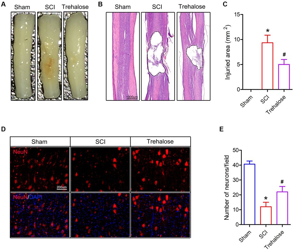 Trehalose attenuates the damaged area and motor neuron loss of SCI in mice. (A) General picture of the spinal cord on day 28 after SCI; (B) HE staining of the spinal cord on day 28 after SCI; (C) Quantification of damage area; (D) NeuN staining around the spinal cord injury area on the 28th day after SCI; (E) Quantitative analysis of neuronal cells. *p #p 