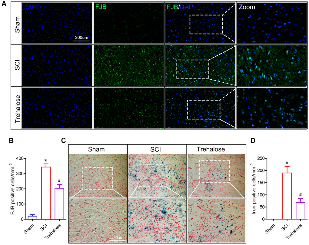 Trehalose inhibits neuronal degeneration and iron accumulation after SCI. (A) On the third day after SCI, FJB stained area of interest and representative images in spinal cord slices; (B) Quantification of FJB positive cells; (C) On the third day after SCI, Perls stained region of interest and representative images in spinal cord slices; (D) Quantification of iron-positive cells; *p #p 